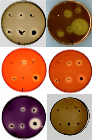 2011_bacterias 2011_bacterias